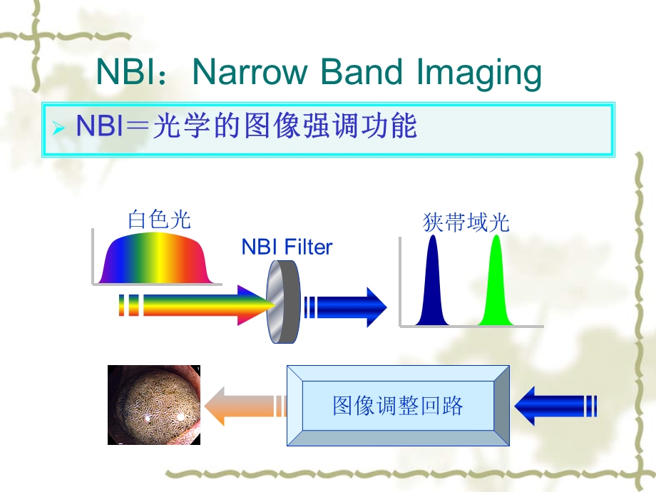 窄带成像(NBI)在内镜诊疗中的应用.ppt_第3页