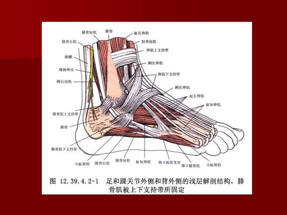 腓骨长短肌腱滑脱.ppt_第3页