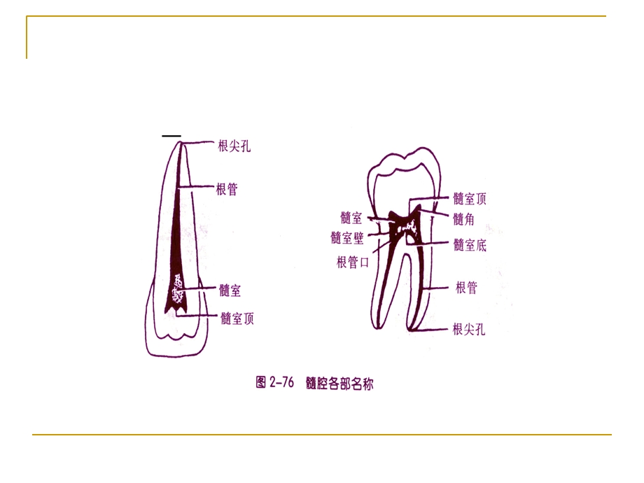 牙体髓腔解剖系统开髓.ppt_第3页