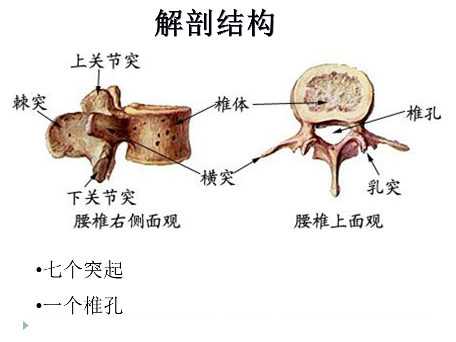 腰椎骨折患者的护理.ppt_第3页