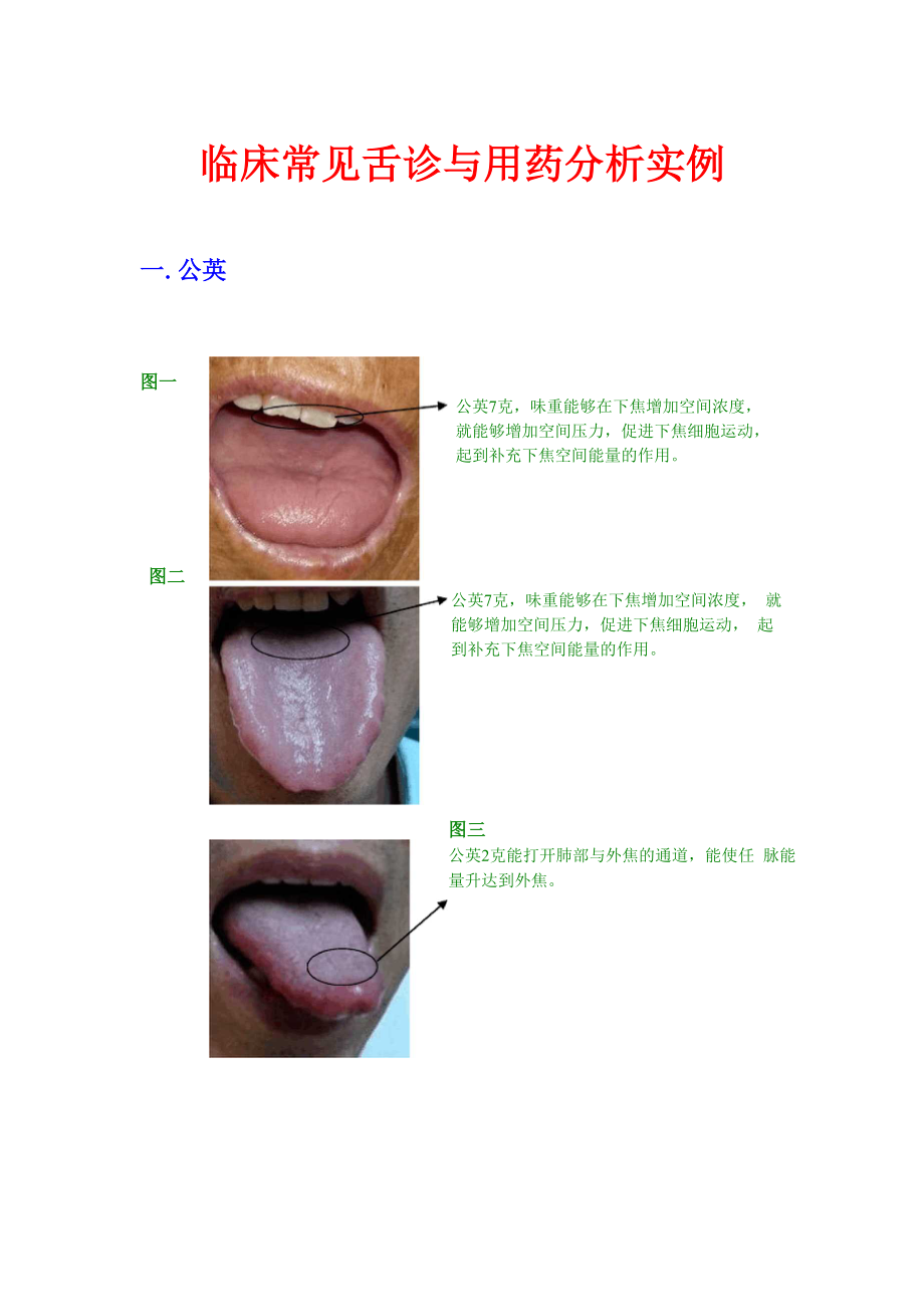 临床常见舌诊与用药分析实例.docx_第1页