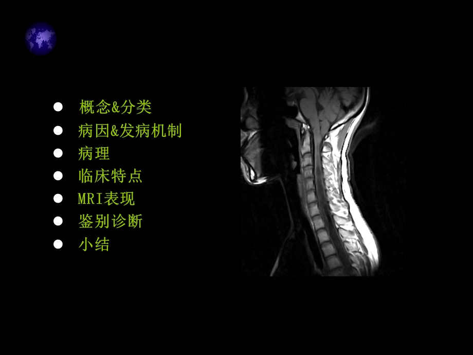 脊髓空洞症MRI表现.ppt_第2页