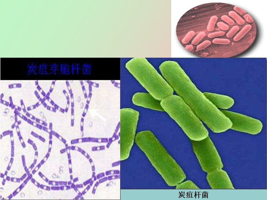 职业性传染病.ppt_第3页