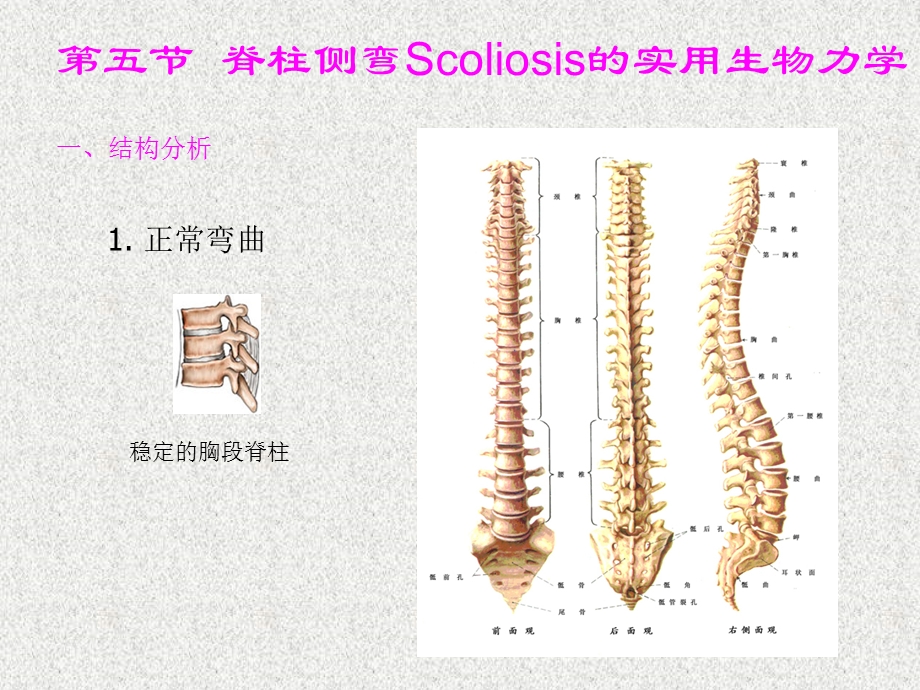 脊柱侧弯生物力学.ppt_第1页