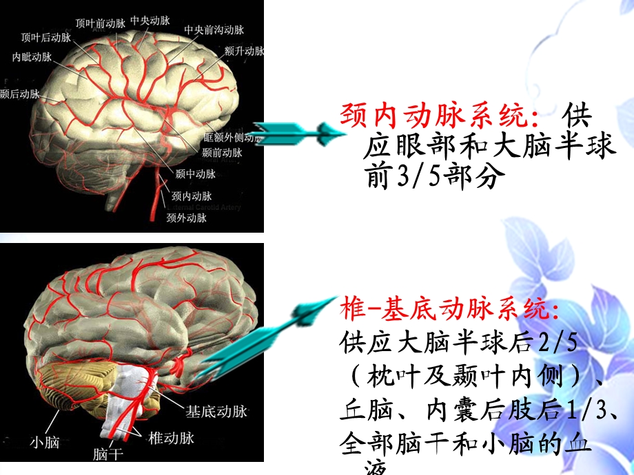 脑血管疾病病人的护理.ppt_第3页