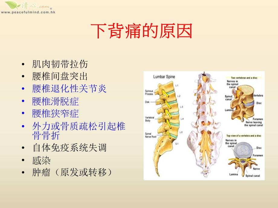 腰背问题探究和保健.ppt_第2页