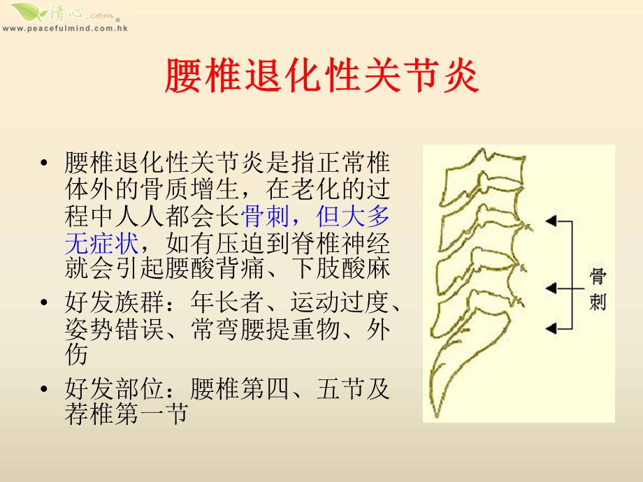 腰背问题探究和保健.ppt_第3页