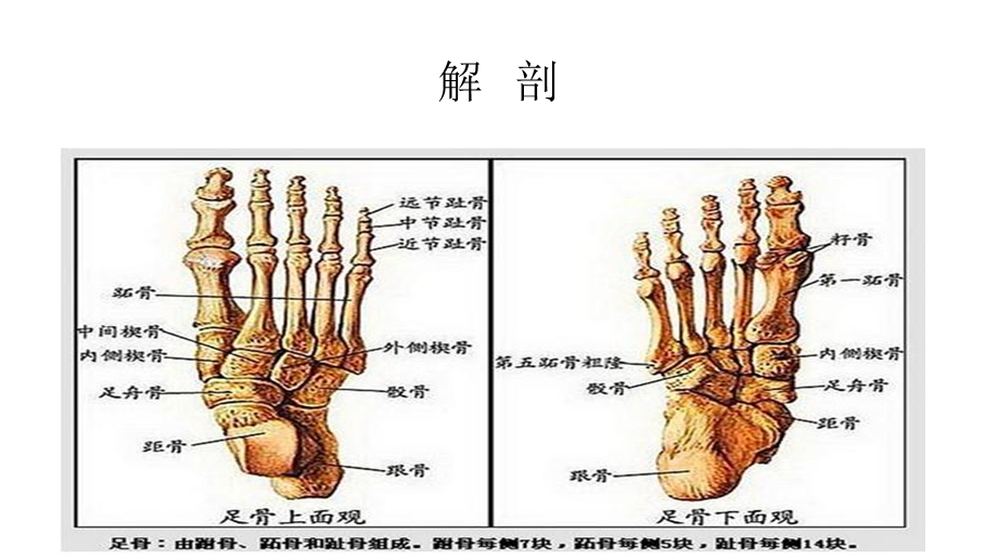 跟骨骨折患者的护理查房.ppt_第2页