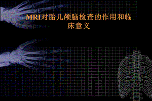 MRI对胎儿颅脑检查的作用和临床意义.ppt