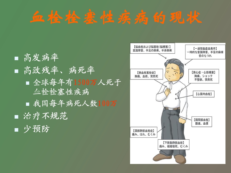 血栓栓塞性疾病的诊断与治疗终.ppt_第3页