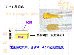 血栓弹力图-血凝仪.ppt