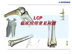 锁定内固定系统临床应用常见问题LCP-Questions.ppt