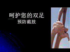 患者教育糖尿病足ppt课件.ppt