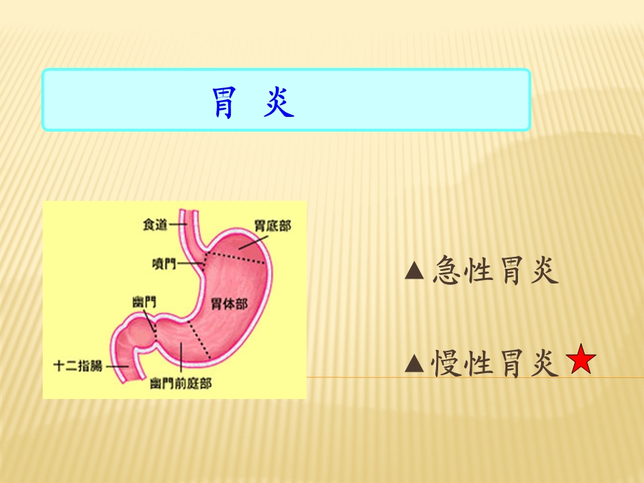 慢性胃炎护理查房.ppt_第2页