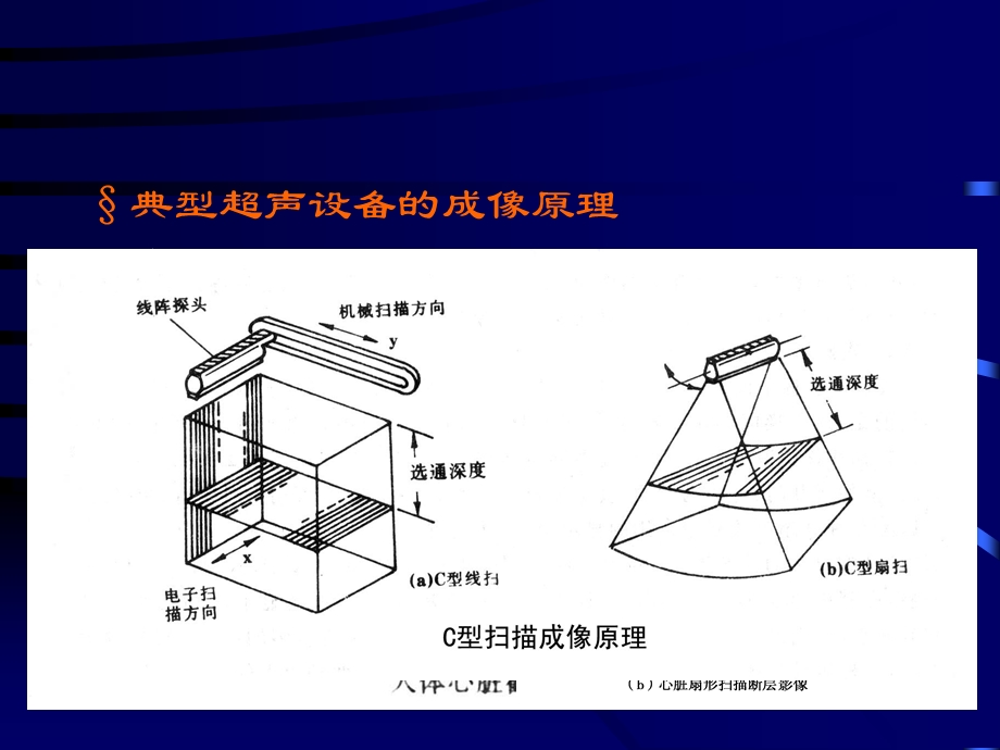 超超声设备成像原理知识重点.ppt_第2页