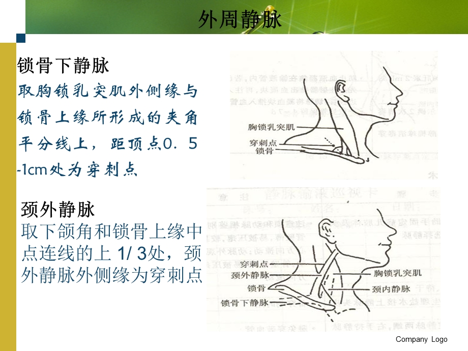 静脉输液ppt课件.ppt_第3页