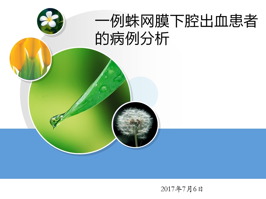 蛛网膜下腔出血患者的病例分析.ppt_第1页