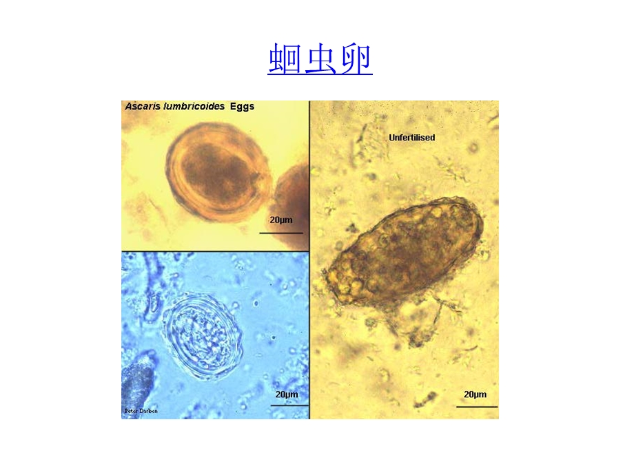 虫学虫卵经典总结及图片.ppt_第2页