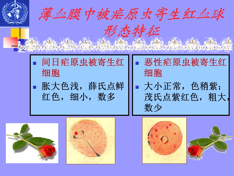 薄血膜疟原虫的形态.ppt_第2页