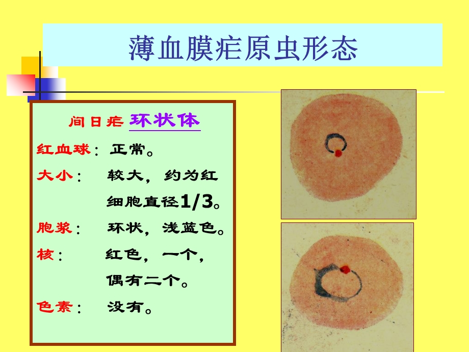 薄血膜疟原虫的形态.ppt_第3页