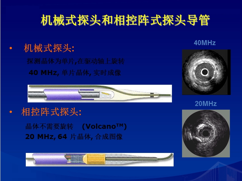 血管内超声IVUS在肺动脉疾病中的应用.ppt_第3页