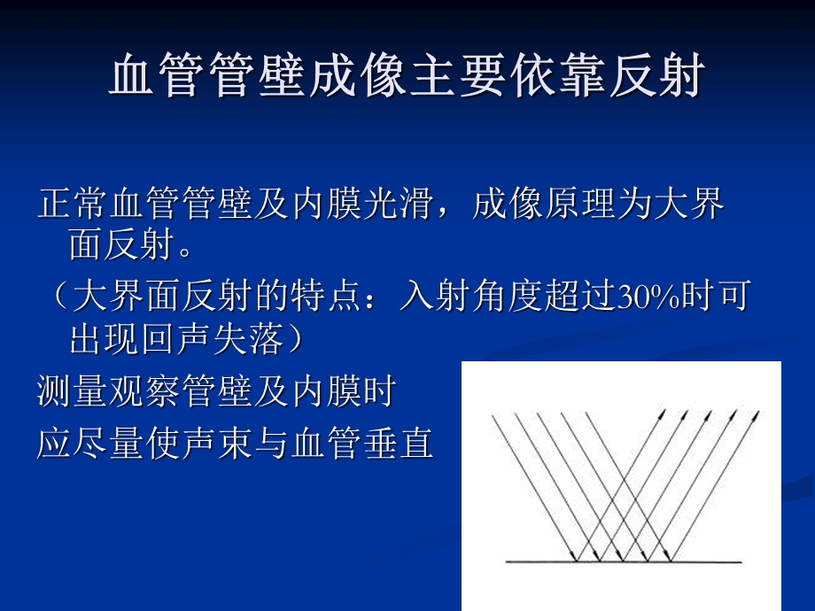 血管超声操作及测量手法.ppt_第2页