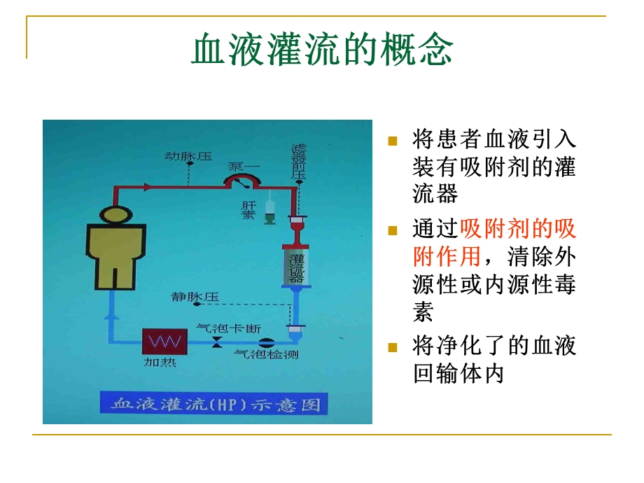 血液灌流的讲座幻灯片.ppt_第2页