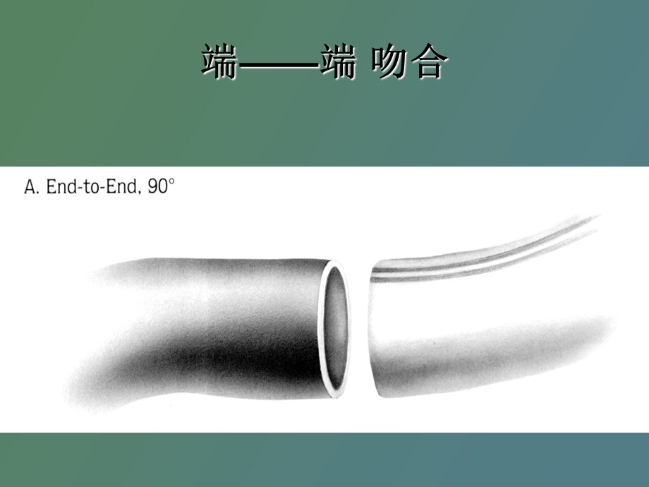 血管吻合技术.ppt_第3页