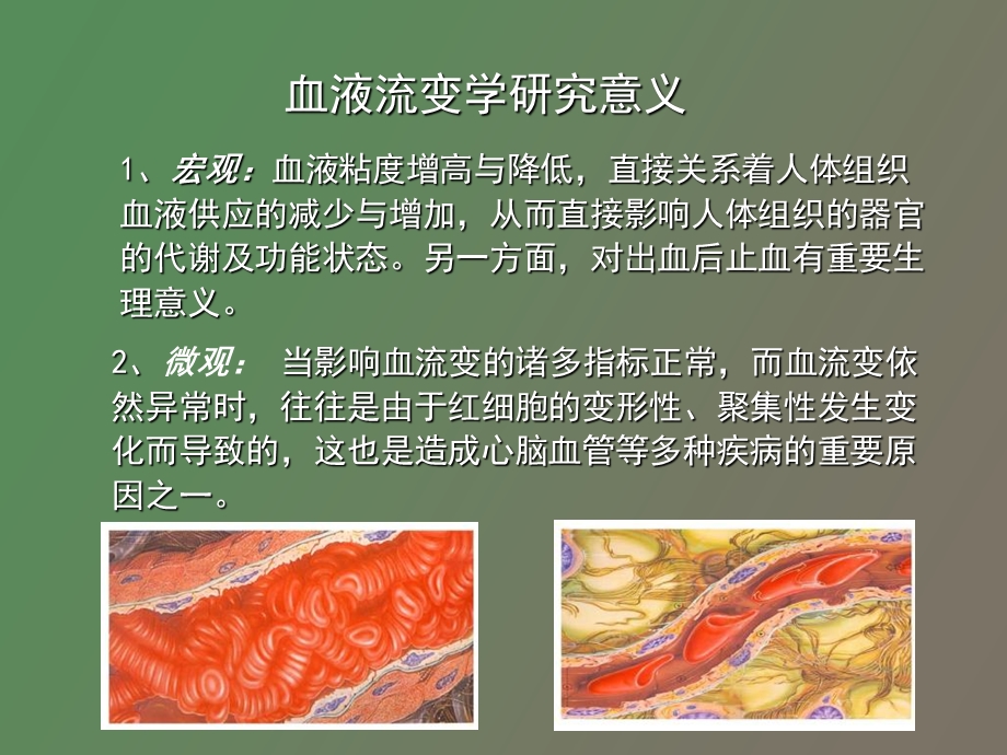 血液流变学的临床.ppt_第3页