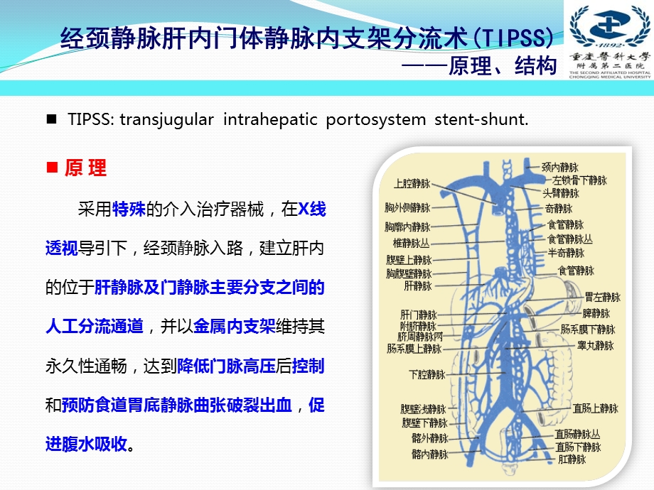 经颈静脉肝内门体分流术TIPS的护理.ppt_第3页