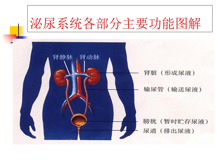 输尿管结石的护理查房.ppt_第3页