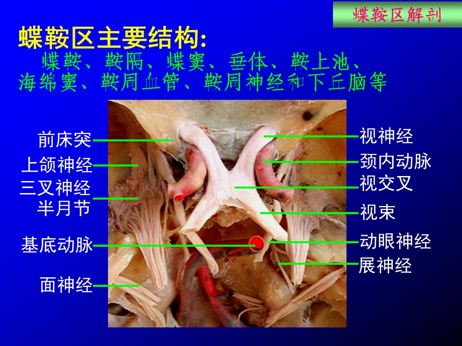 蝶鞍区应用解剖.ppt_第3页