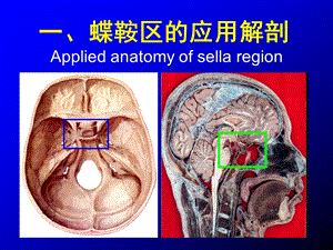 蝶鞍区应用解剖.ppt