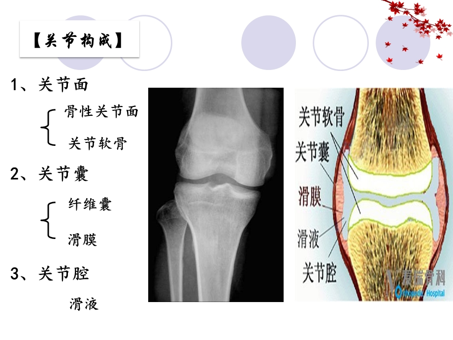 慢性骨关节病影像表现ppt课件.ppt_第3页