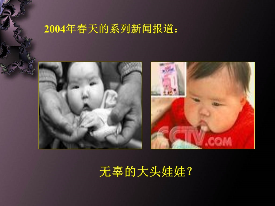 第六章水肿 ppt课件.ppt_第1页