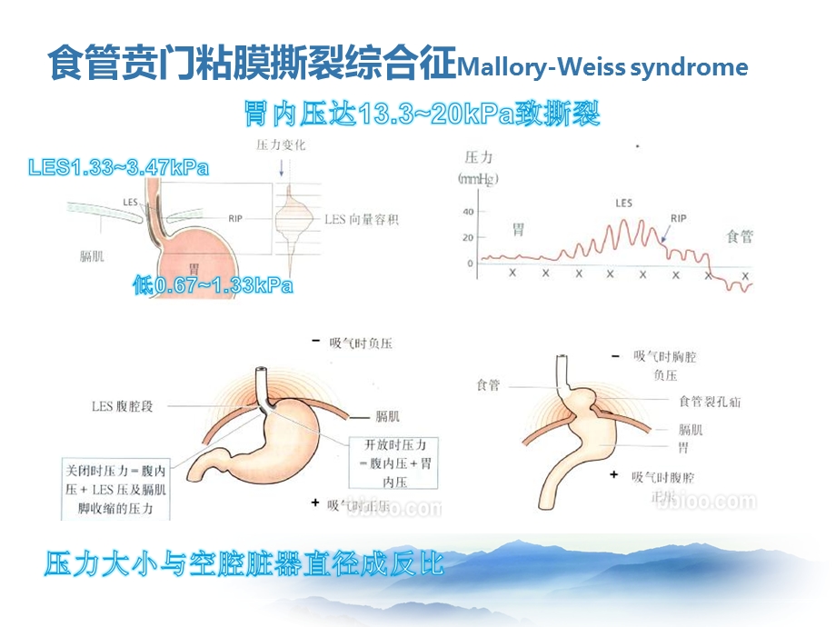 上消化道出血少见病因.ppt_第3页