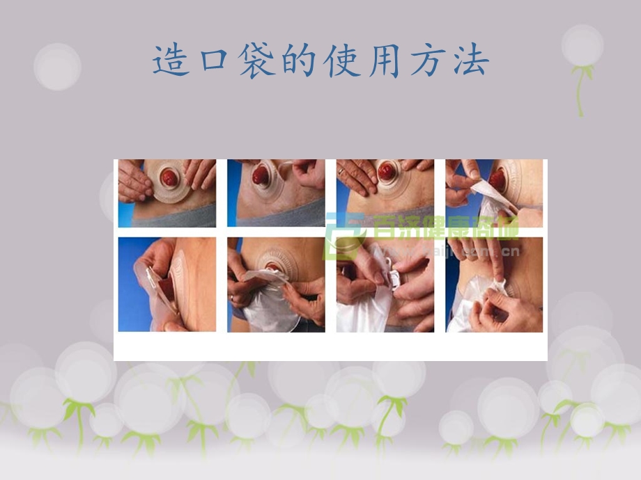 造口病人的生活护理与指导.ppt_第3页