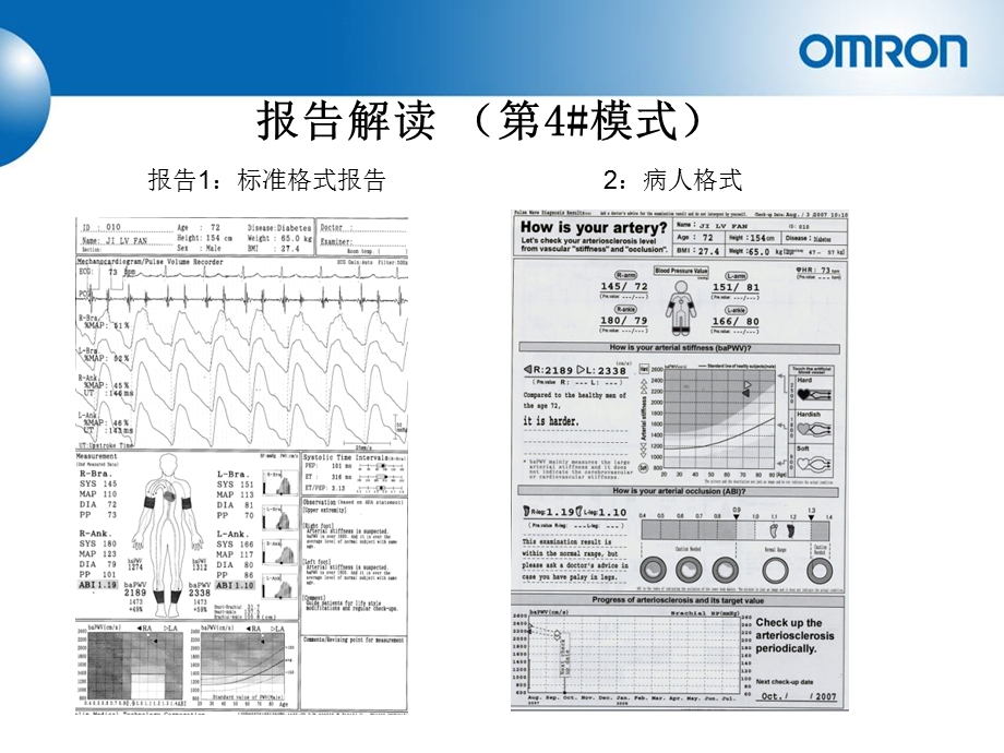 重要脉搏波传导速度PWV.ppt_第2页