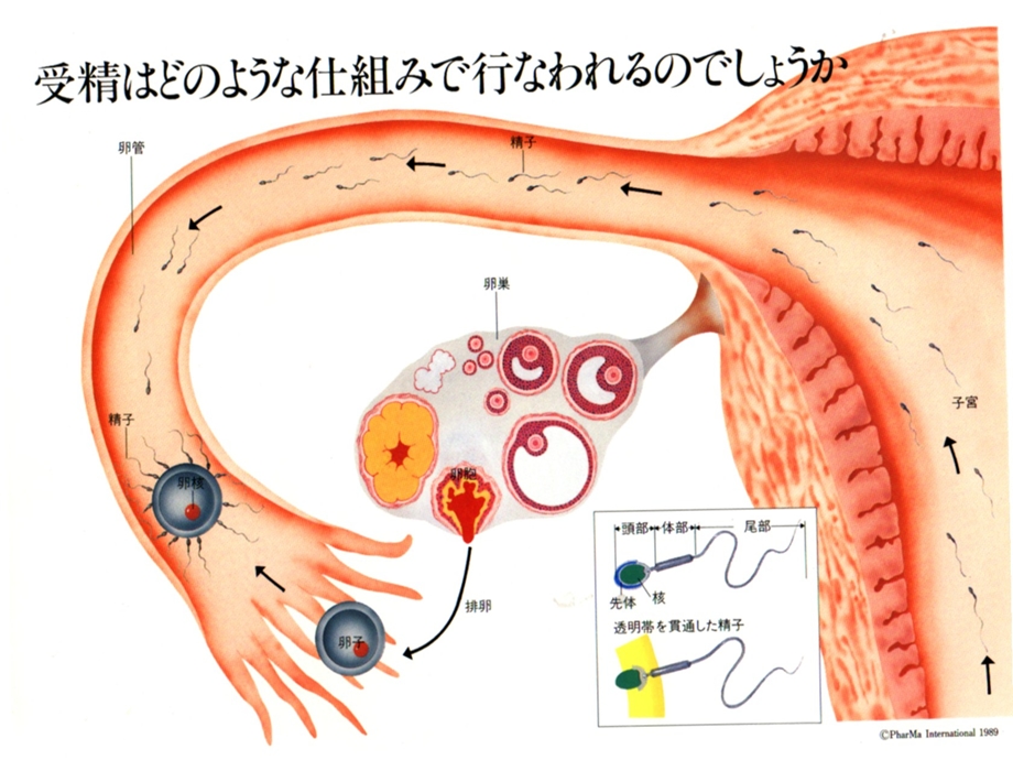 不孕症Infertility.ppt_第3页