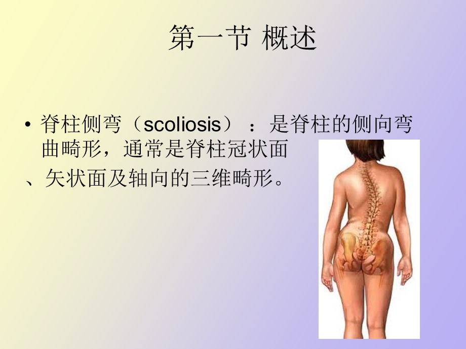 运动学脊柱侧弯.ppt_第2页