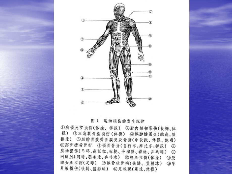 运动损伤的应急处理.ppt_第3页