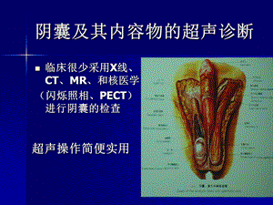 阴囊及其内容物的超声诊断.ppt