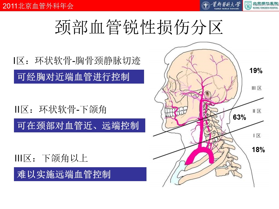 颈肩部大血管损伤的外科处理.ppt_第3页