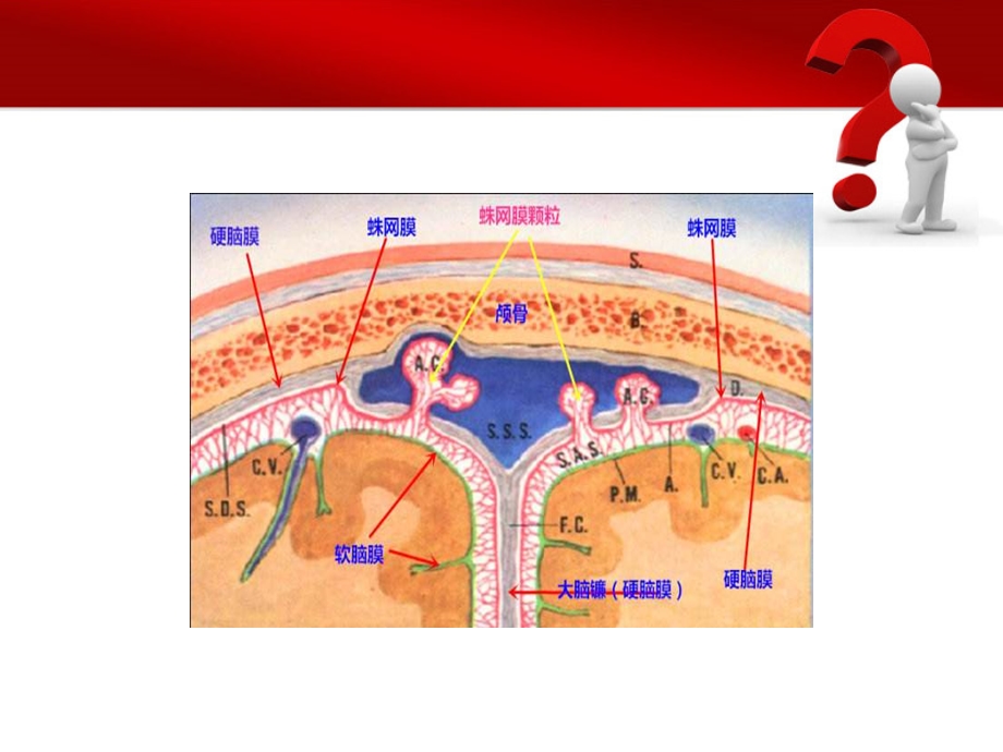 蛛网膜下腔出血的护理措施.ppt_第3页