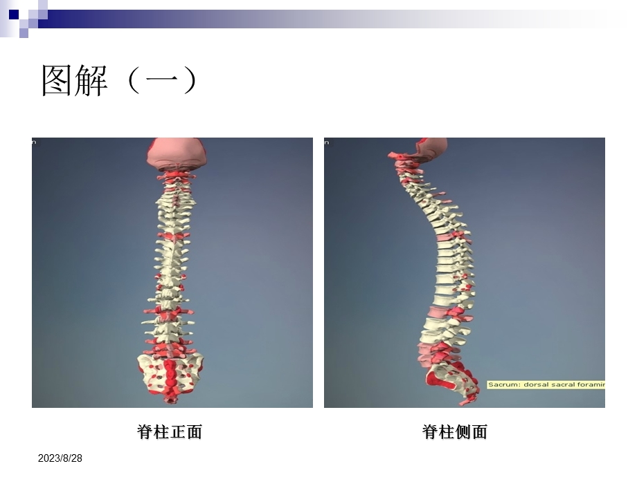 针刀治疗在脊柱源性疼痛中的作用.ppt_第3页