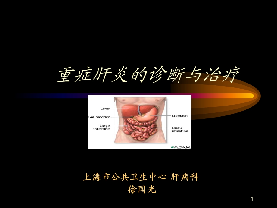 重症肝炎的诊断与治疗.ppt_第1页