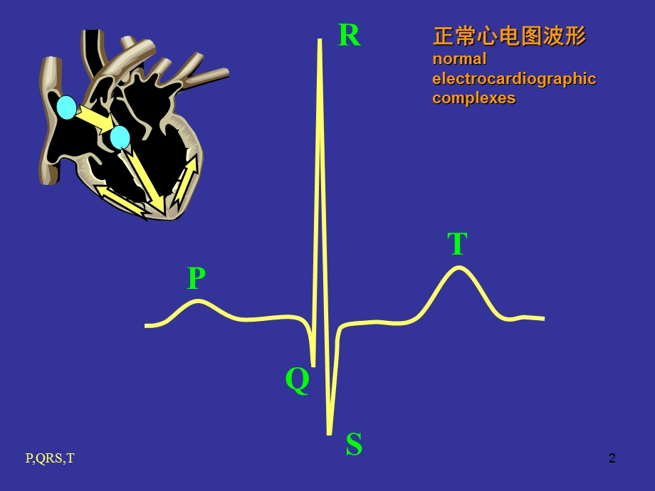 临床心电图教程-心电图分析步骤与要点.ppt_第2页