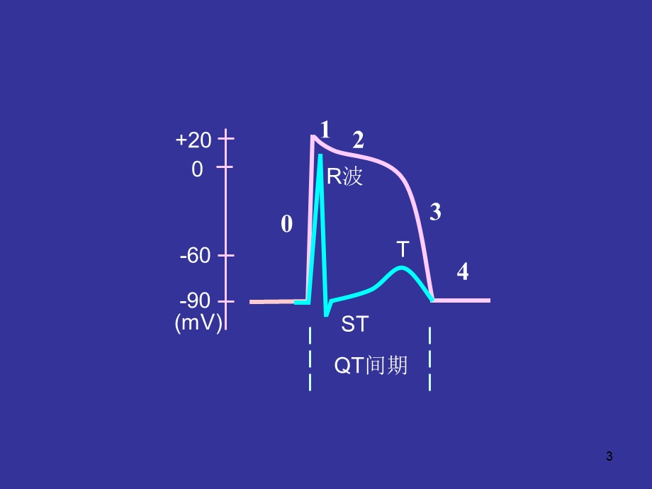 临床心电图教程-心电图分析步骤与要点.ppt_第3页