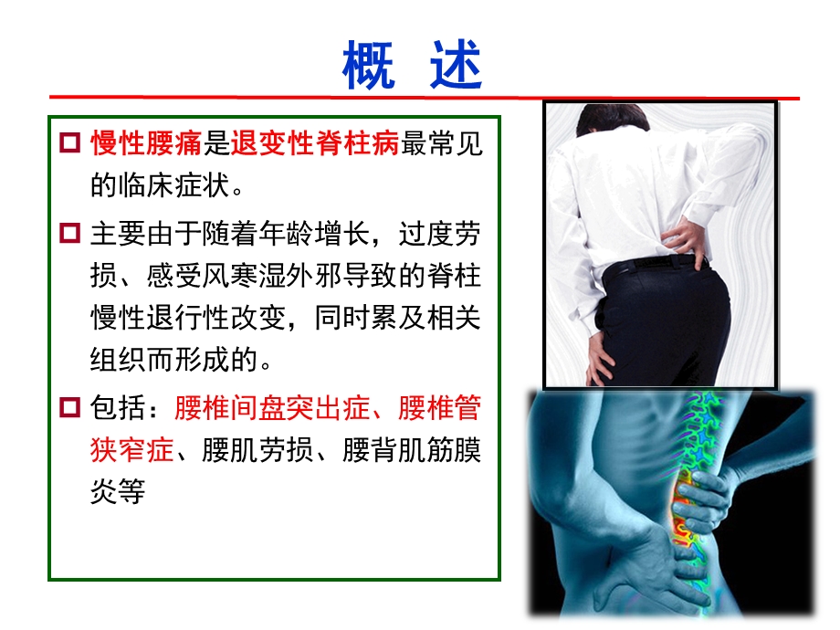 慢性腰痛的中医康复治疗策略ppt课件.ppt_第2页