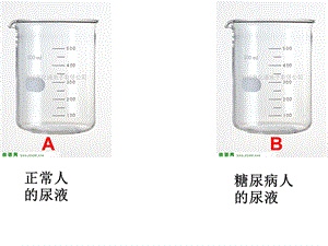 血糖调节的模型建构.ppt